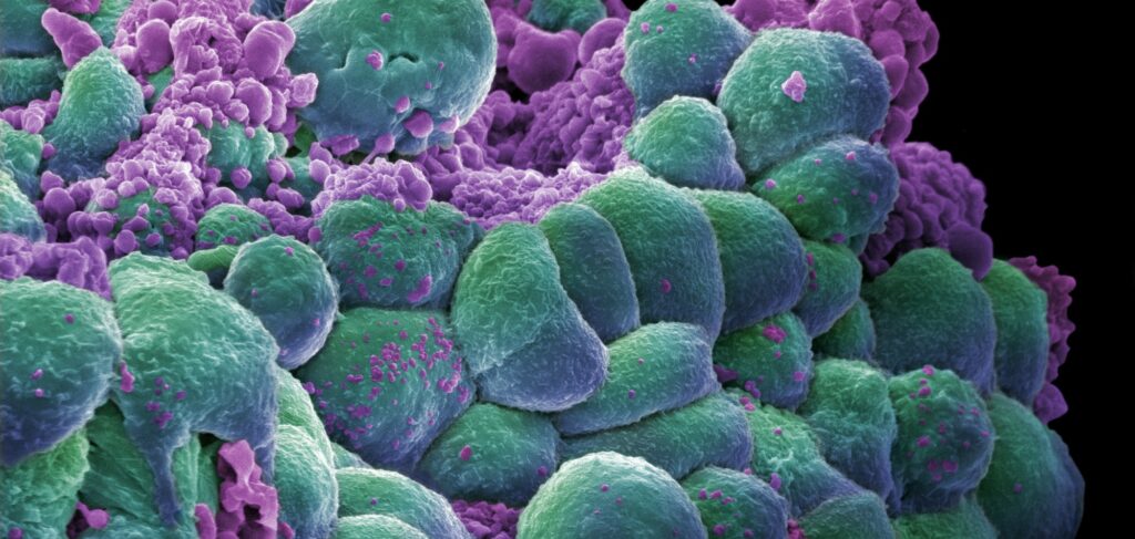 Treating Tumors with Your Own Antibodies